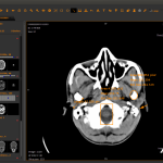 دانلود کرک نرم افزار تصویربرداری Sonic Dicom دایکام PACS پزشکی