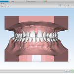 دانلود کرک نرم افزار ماسترو دنتال Maestro 3D Dental دندانپزشکی