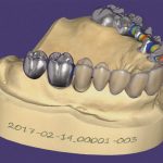 نرم افزار دندانپزشکی اگزو کد ۲۰۱۸ ExoCad Dental Cad  اگزوکد ایمپلنت