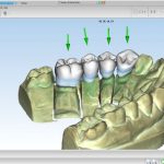 کرک نرم افزار ماسترودنتال Maestro 3D Dental دندانپزشکی